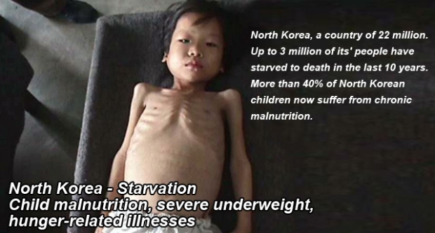 North Korea children severe underweight