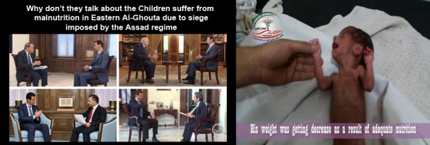 syria_assad_Ghouta_hungry_child_1