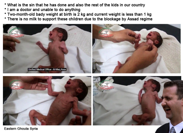 syrian assad starving babies to death Ghouta