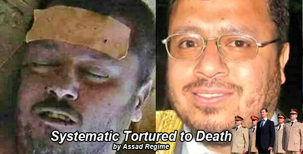 Systematic torture to death by assad regime